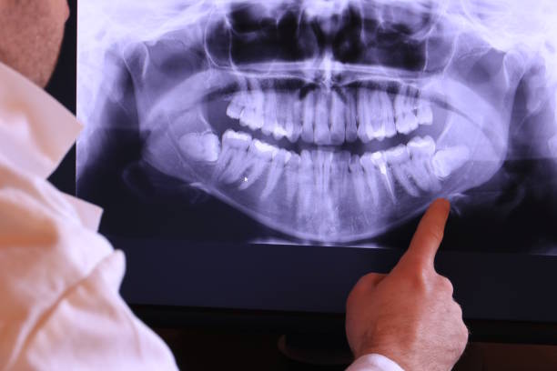Best Root Canal Emergency Dentist  in Portageville, MO